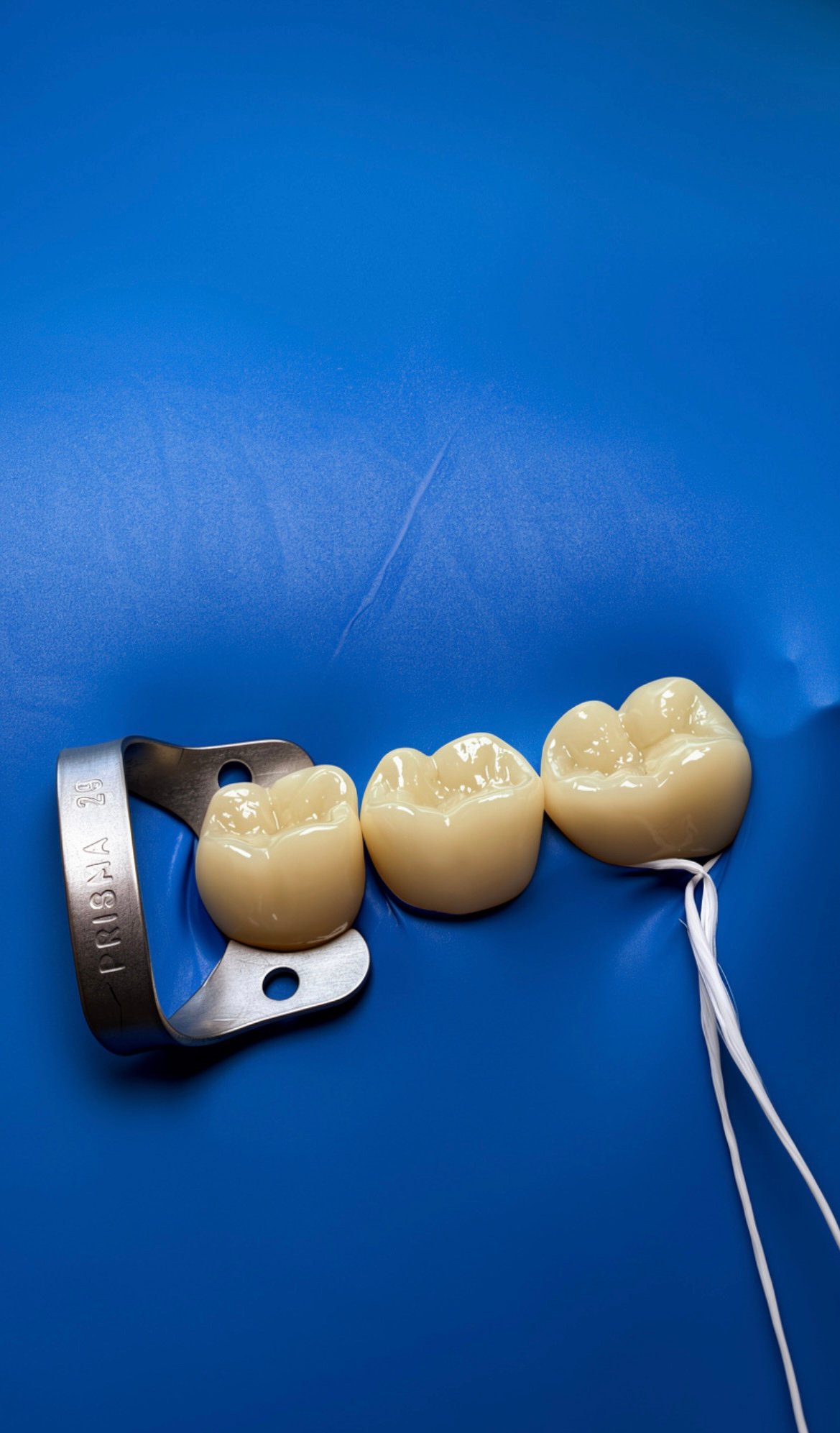 Restaurações dentárias de alta precisão — Concha Bolsoni